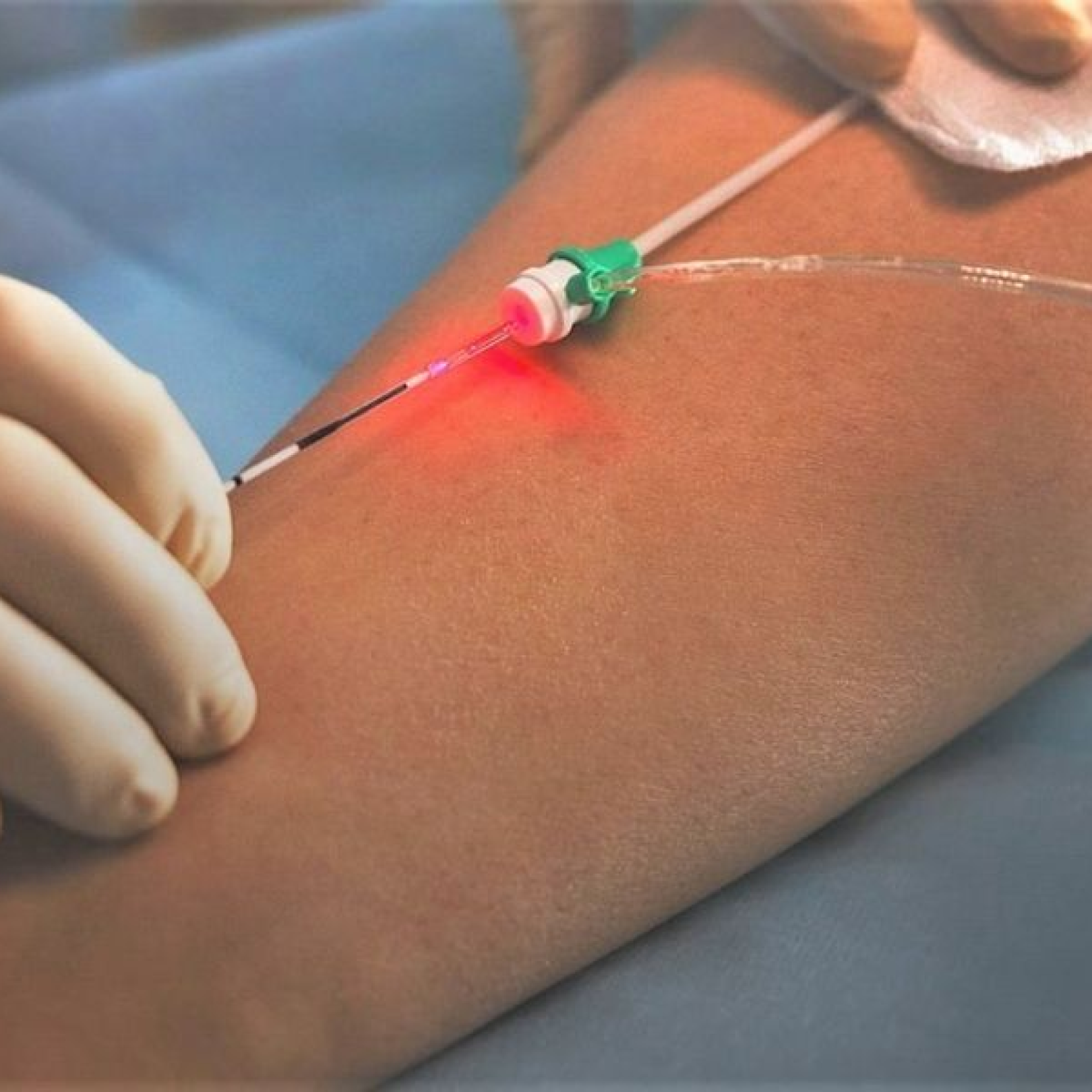 Dra Laís Faina - Cirurgia Endolaser