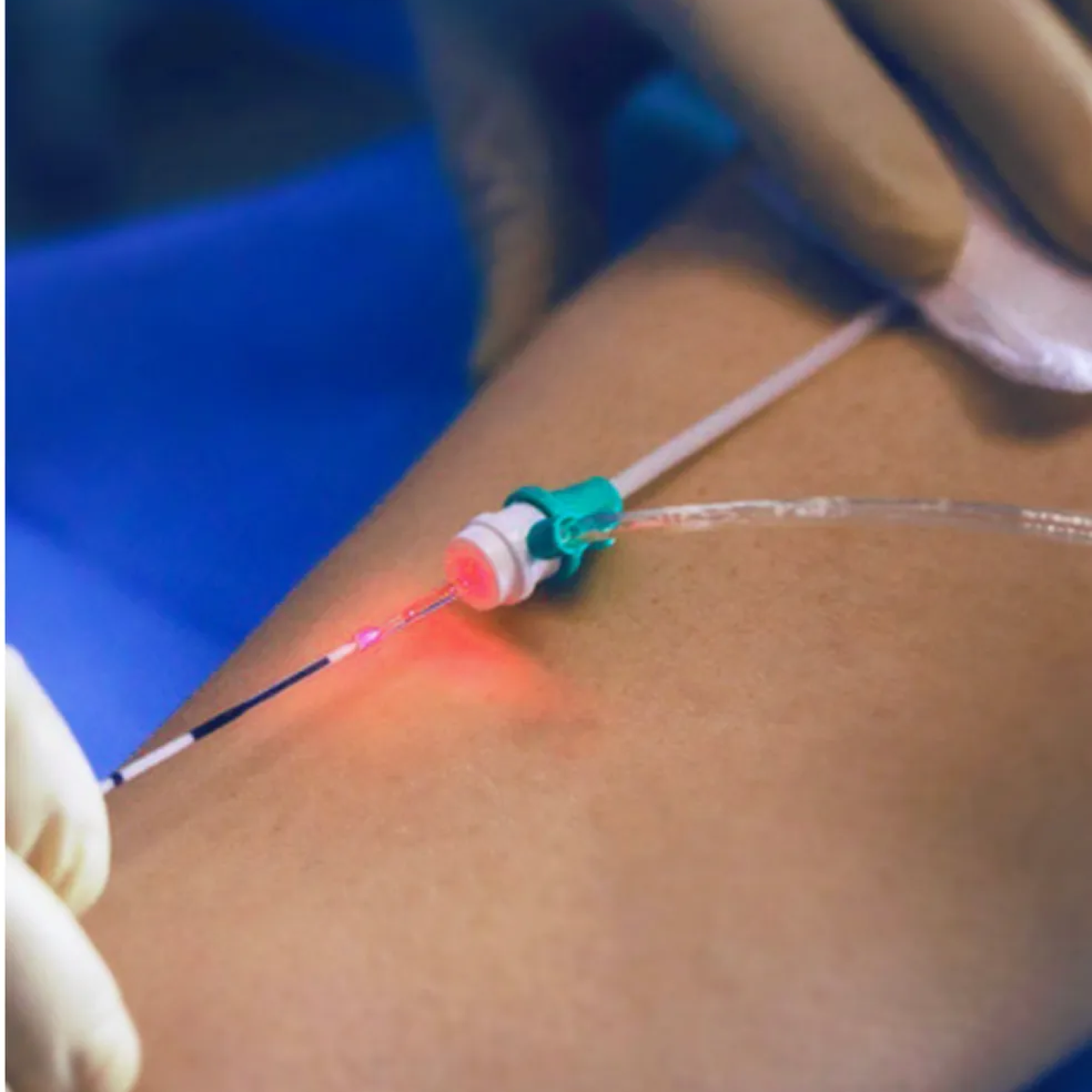 Dra Laís Faina - Cirurgia Endolaser