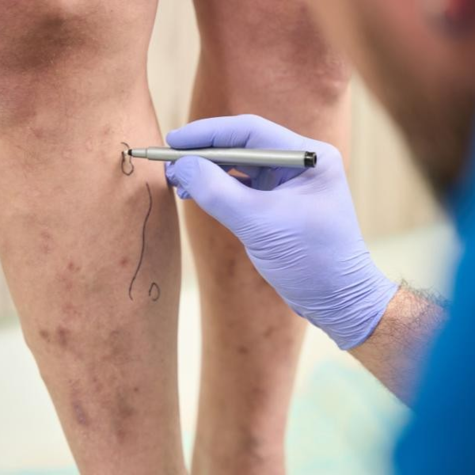 Dra Laís Faina - Cirurgia Minimamente Invasiva