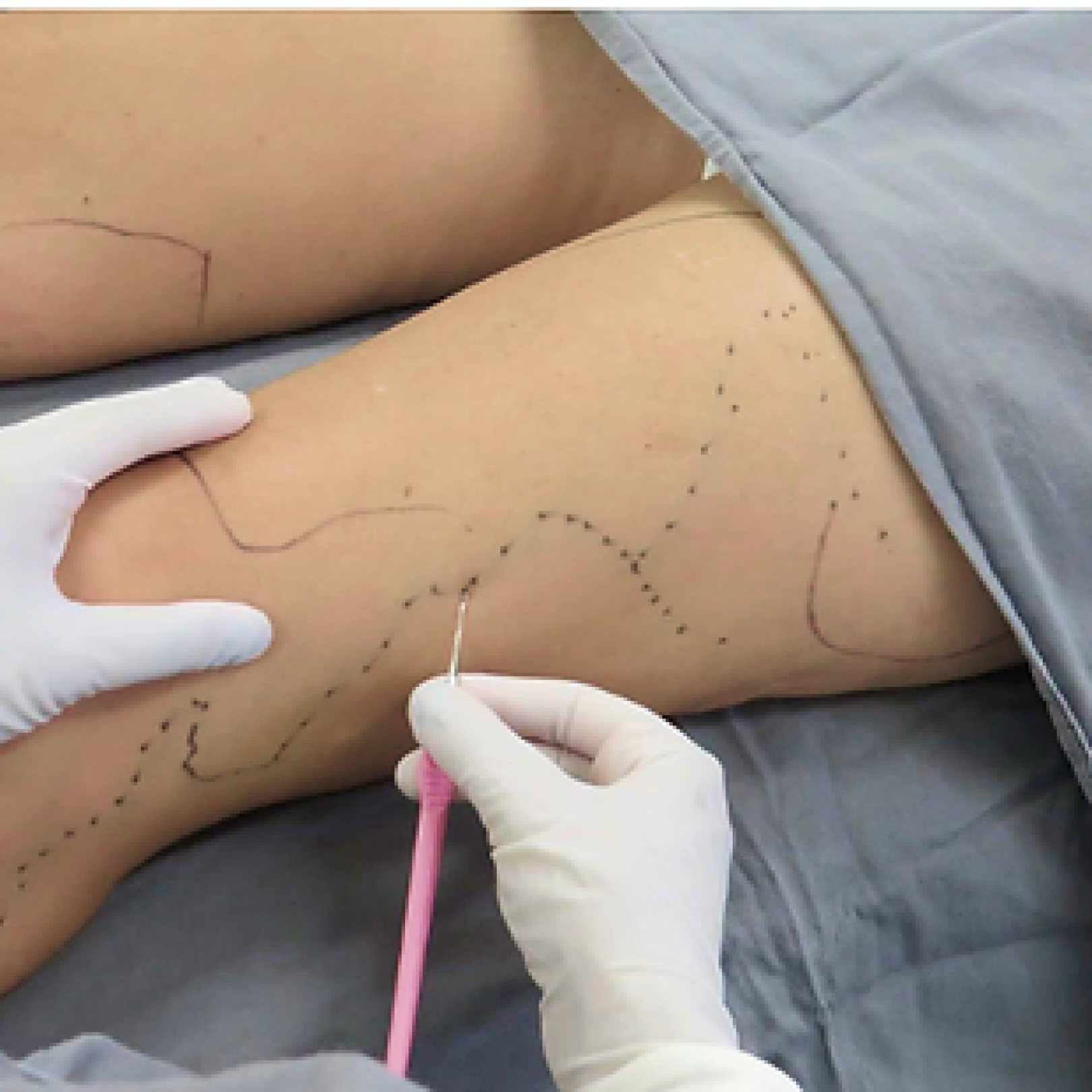 Dra Laís Faina - Cirurgia Minimamente Invasiva