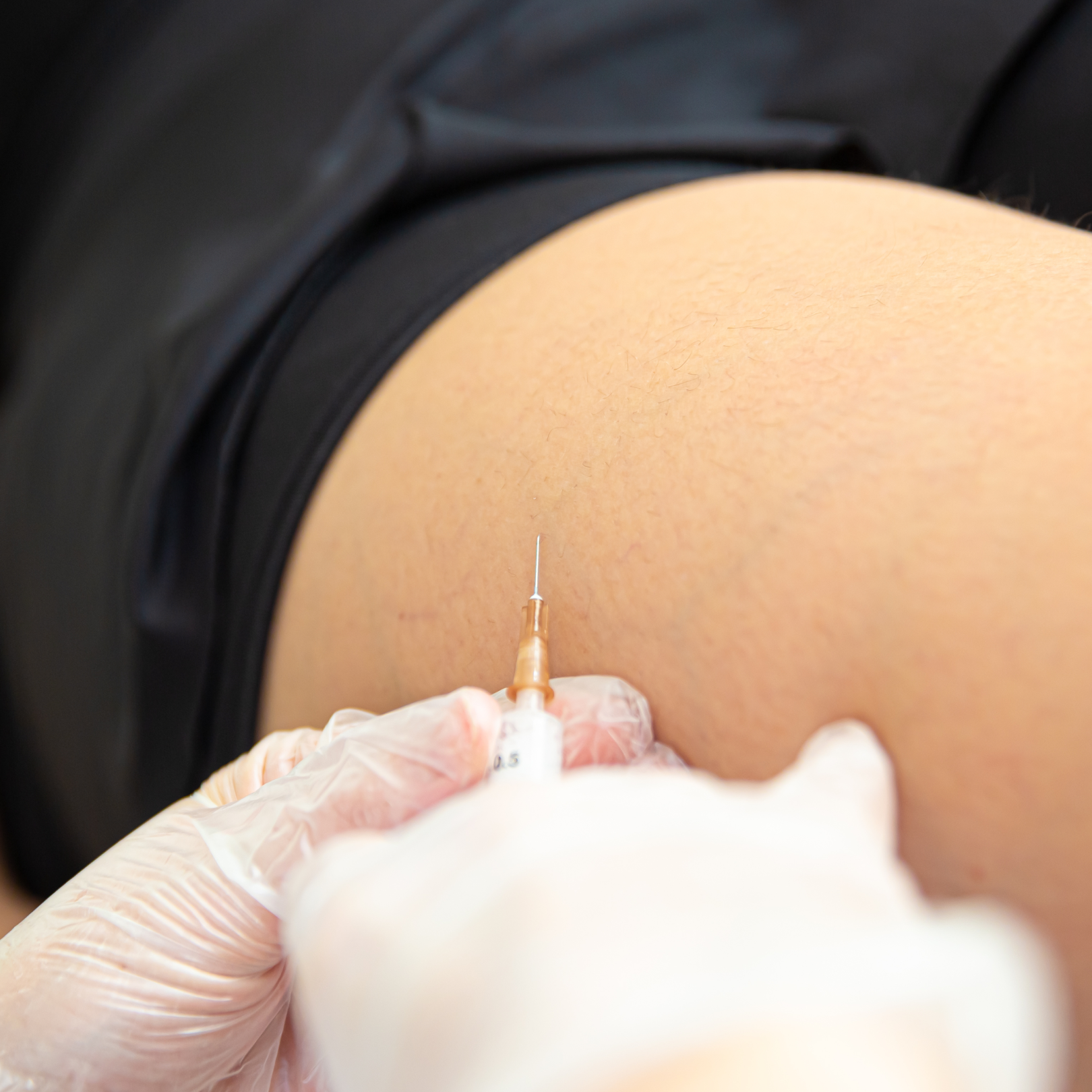 Dra Laís Faina - Escleroterapia