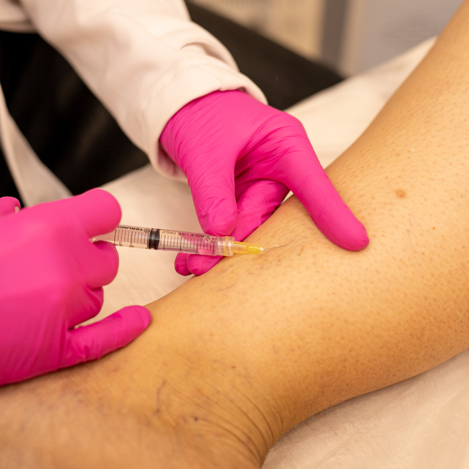 Dra Laís Faina - Escleroterapia