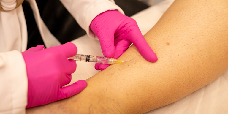 Escleroterapia